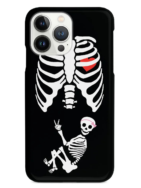 Expecting Skeleton Mom - Girl Case